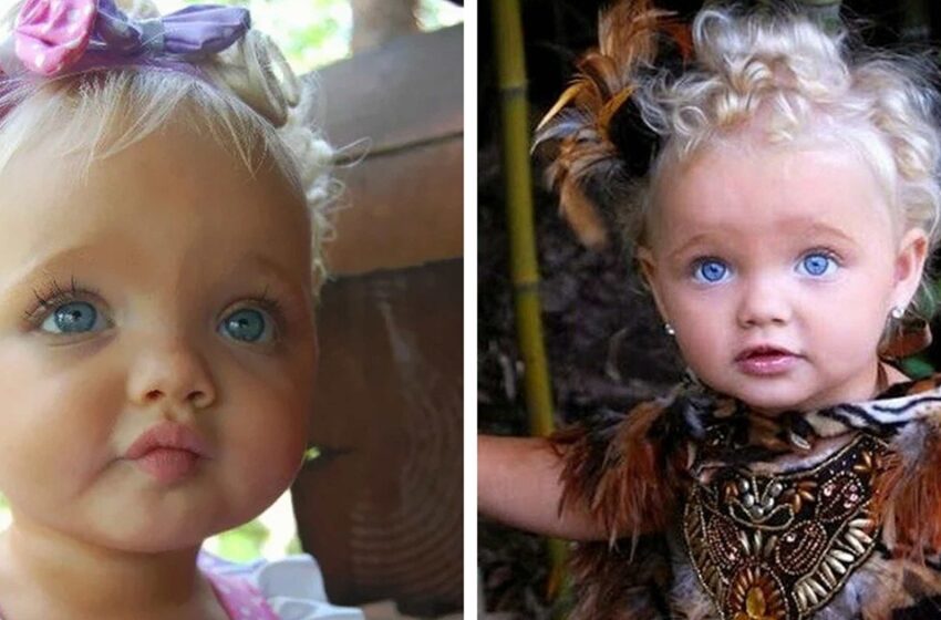 “A Girl Born With a Doll-Like Appearance”: What Does She Look Like Now?