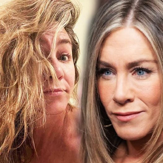 Jennifer Aniston opens up about her plastic surgery, says she’ll never inject “s**t into my face”