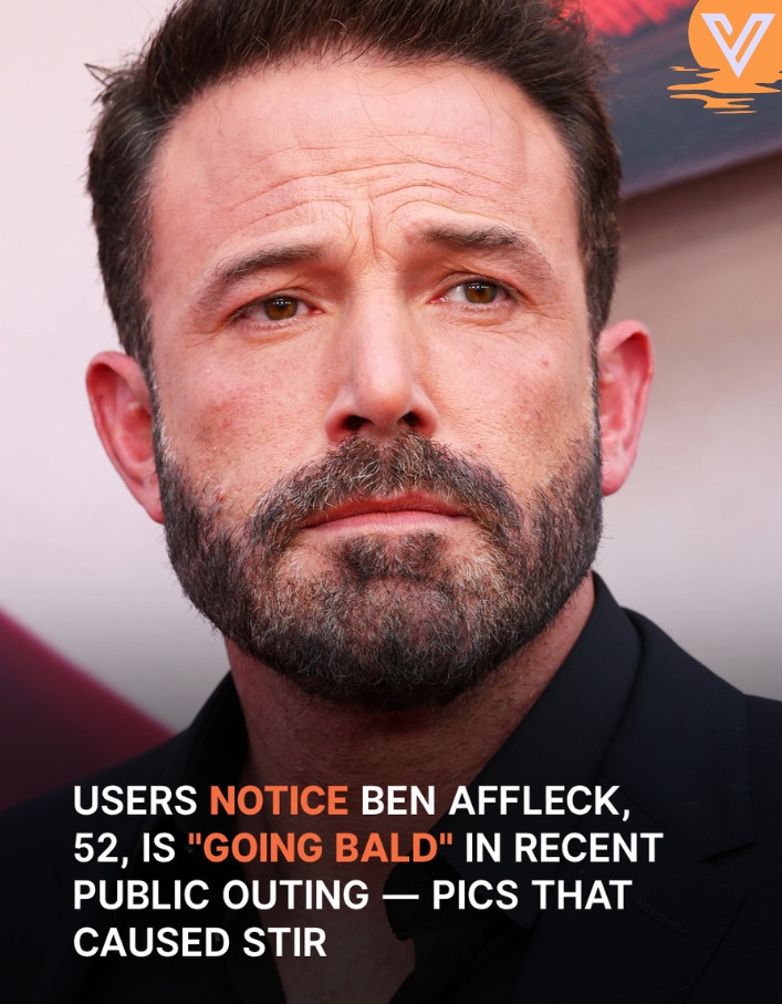 ‘He’s Going Bald!’ Fans React to Ben Affleck’s Unrecognizable New Look!